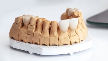 From Stained to Stunning: How Dental Veneers at Bliss Dental Arts Changed These Smiles?