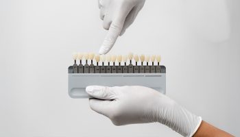 From Stained to Stunning: How Dental Veneers at Bliss Dental Arts Changed These Smiles